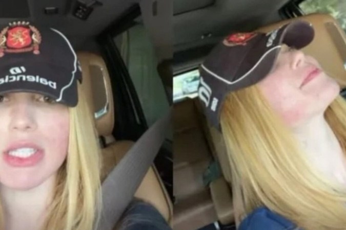 Arrependida! Virginia faz desabafo sobre procedimento no rosto após ficar em carne viva -  (crédito: Observatório dos Famosos)