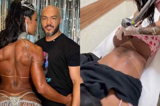 VÍDEO: ao som de Belo, Gracyanne Barbosa remove tatuagem íntima dedicada ao ex -  (crédito: Observatório dos Famosos)