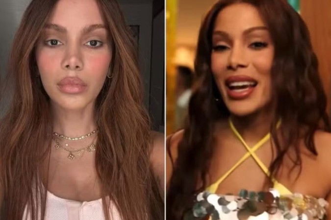 Anitta diz que está diferente das fotos e responde crítica de amigo: ‘Era pra falar na hora’ -  (crédito: Observatório dos Famosos)