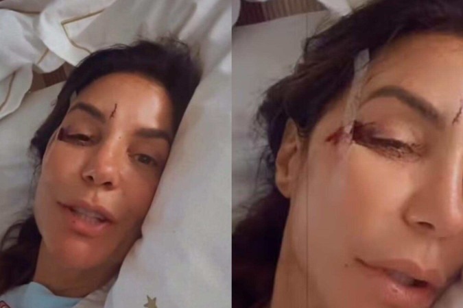 Ivete Sangalo é hospitalizada após desmaiar no banheiro e sofrer ferimentos no rosto -  (crédito: Observatório dos Famosos)