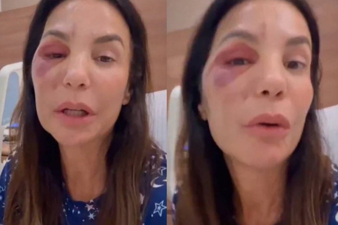 Ivete Sangalo se manifesta sobre rumores de ter sofrido agressão após cirurgia -  (crédito: Observatório dos Famosos)