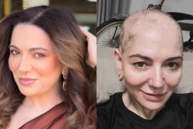 Mãe de Lucas Lucco raspa a cabeça após diagnóstico de doença autoimune -  (crédito: Observatório dos Famosos)