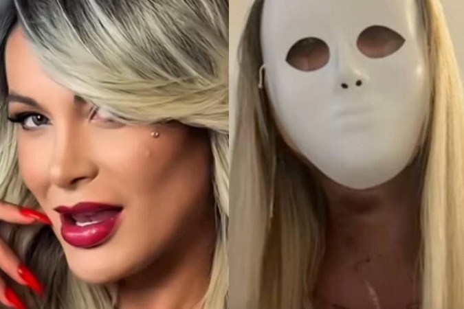 Andressa Urach revela transformação radical no rosto e usa máscara: “Vou voltar a ter 23 anos” -  (crédito: Observatório dos Famosos)